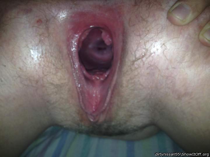 Hard fisting gape