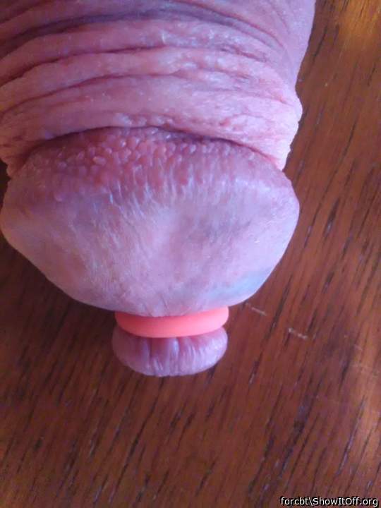 Photo of a penile from forcbt