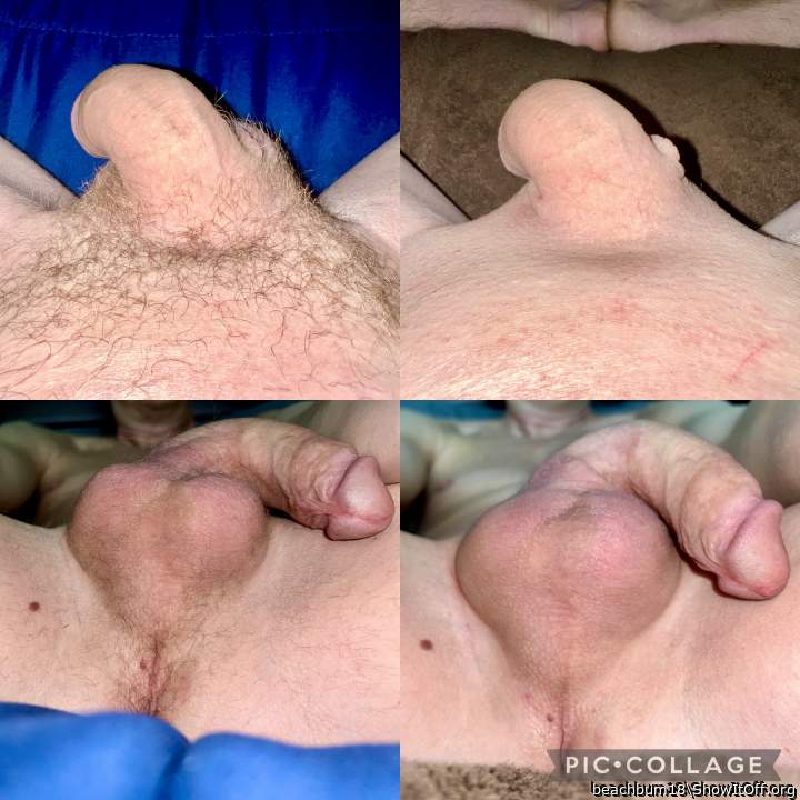 Before and afters