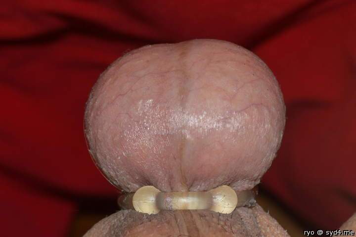Testicles Photo from ryo