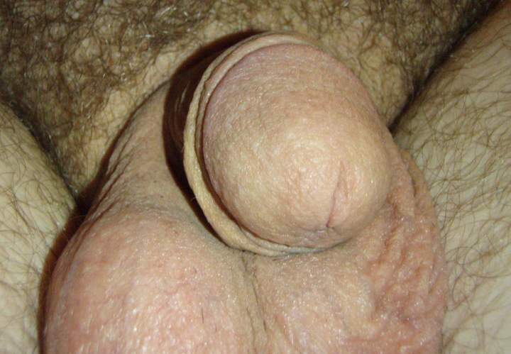 Photo of a short leg from lilsoftee
