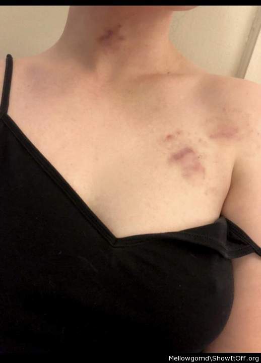 Photo of a third leg from brattybitch