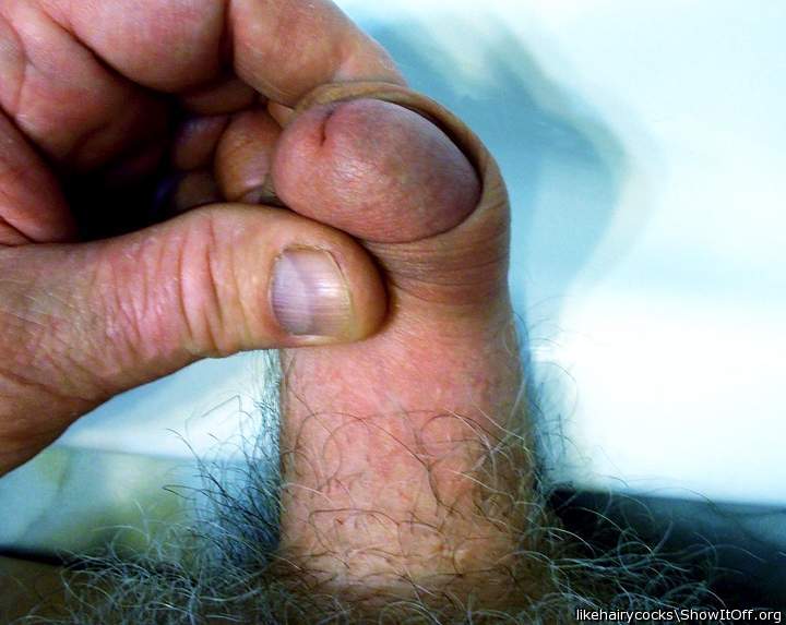 gimme some skin..... foreskin restoration