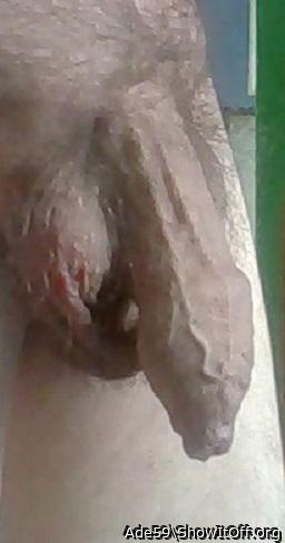 Your foreskin looks very Lovely 