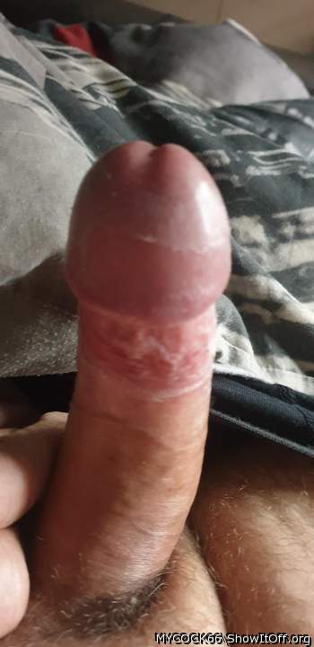Really nice to see what is hidden under your foreskin