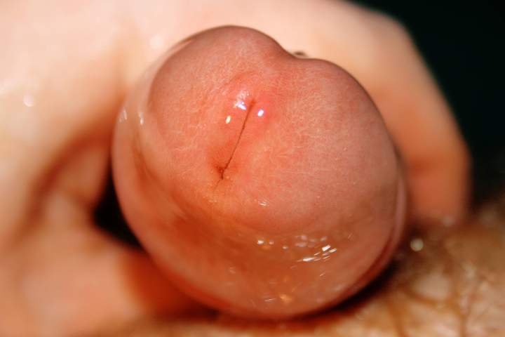 Photo of a phallus from Vanillacum