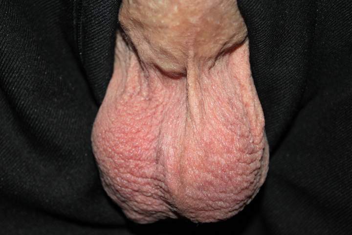Testicles Photo from lilsoftee