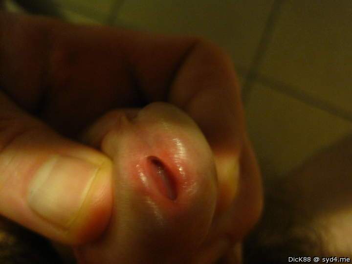 Photo of a wiener from Dick88
