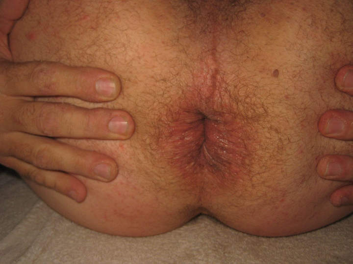 my lonely hole.
