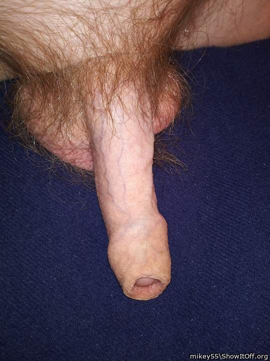 Foreskin