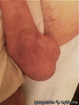 Testicles Photo from PoopSmith
