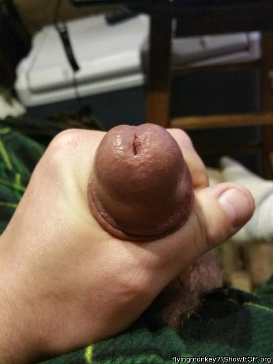 Photo of a short leg from flyingmonkey7