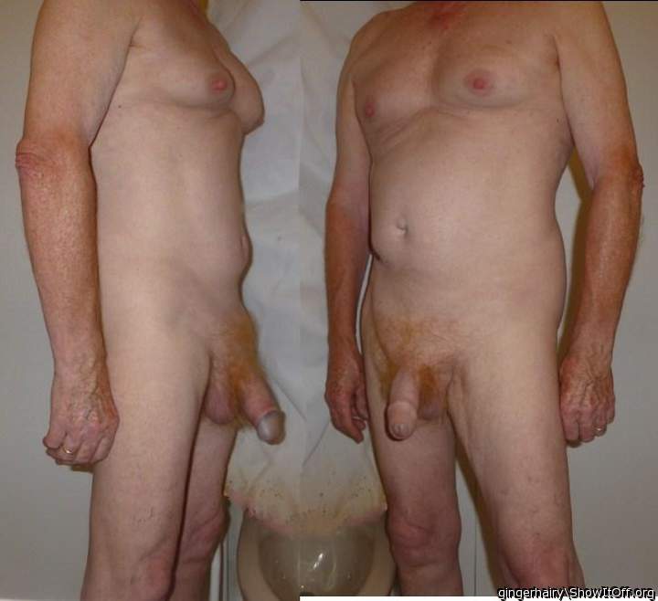 Photo of a short leg from gingerhairy