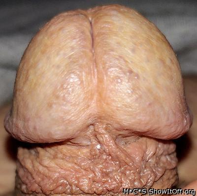Photo of a private part from M*C*S