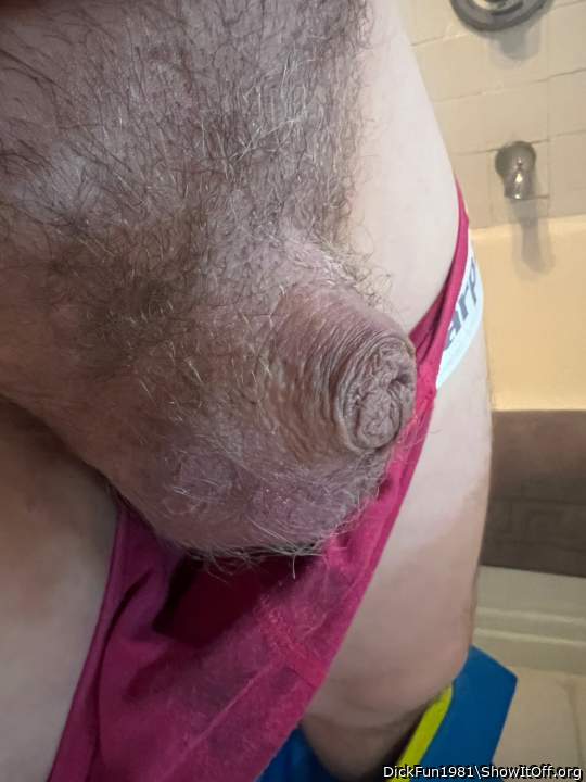 Photo of a penile from DickFun1981