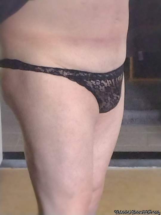 Photo of a short leg from CDAnita