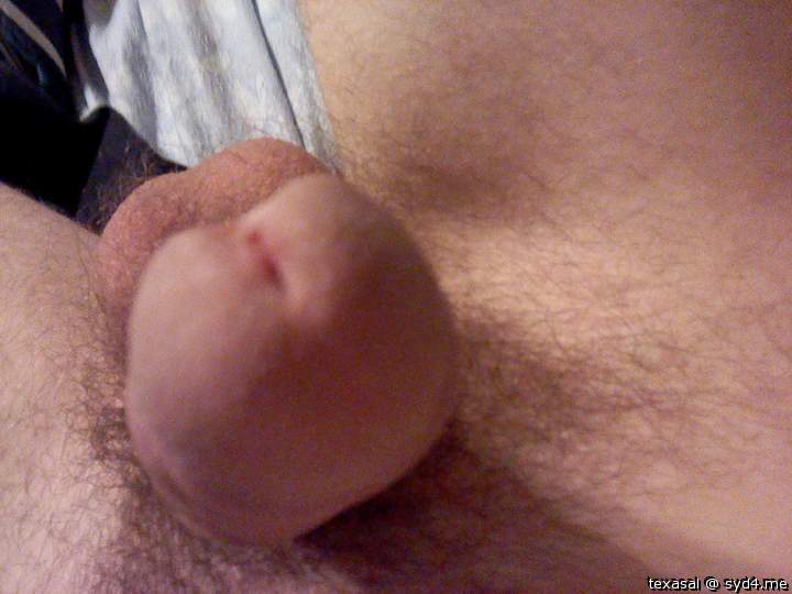 Photo of a short leg from texasal