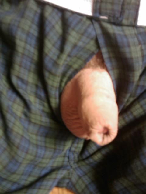 Photo of a meat stick from yardog319
