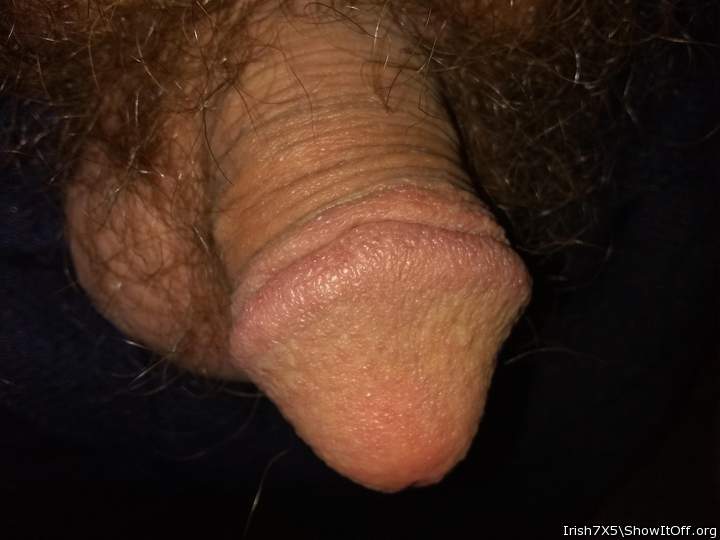 Perfectly circumcised.  