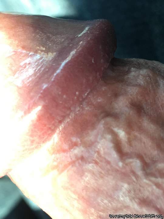 Close ups