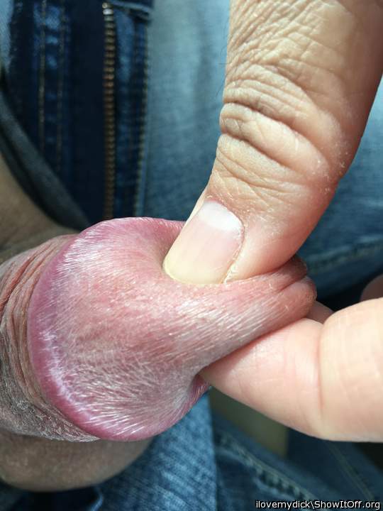 Can I pinch it ??