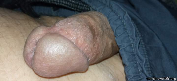 Photo of a middle leg from imi