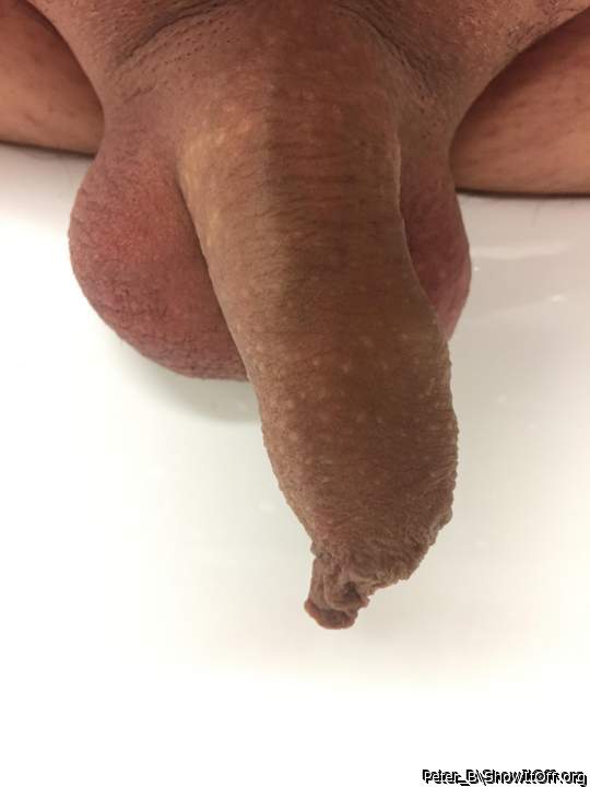 Fantastic foreskin 