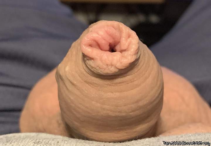 Foreskin