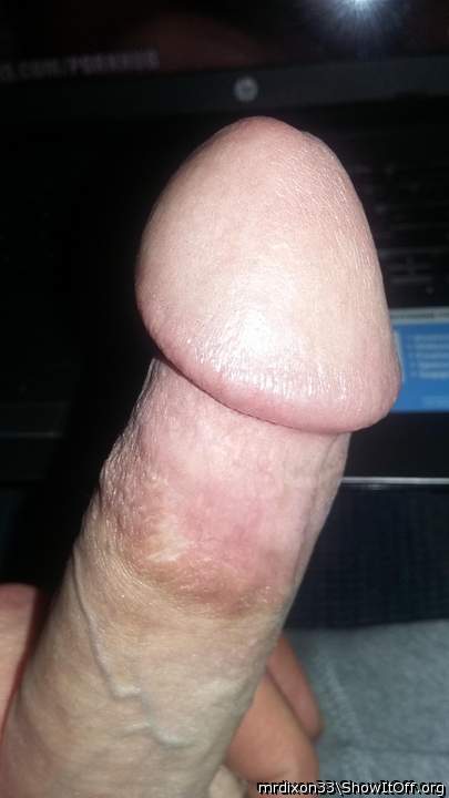 Photo of a snake from Mrdixon33