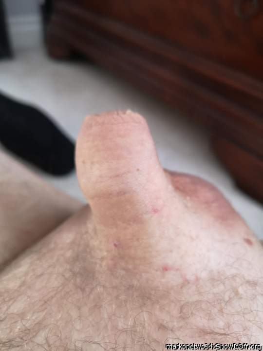 Photo of a private part from markonetwo34