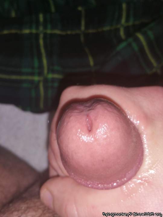 Photo of a short leg from flyingmonkey7