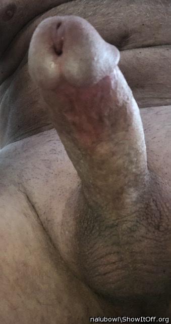  looks like two peeholes?? please explane 