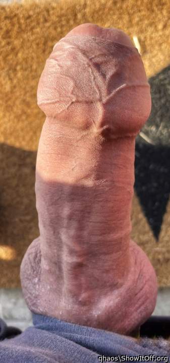 Anatomy of a tight foreskin