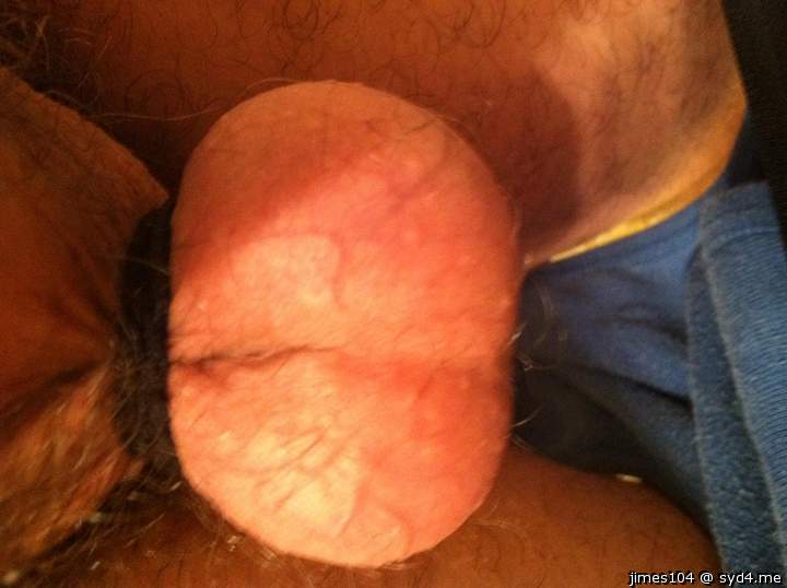 Testicles Photo from jimes104