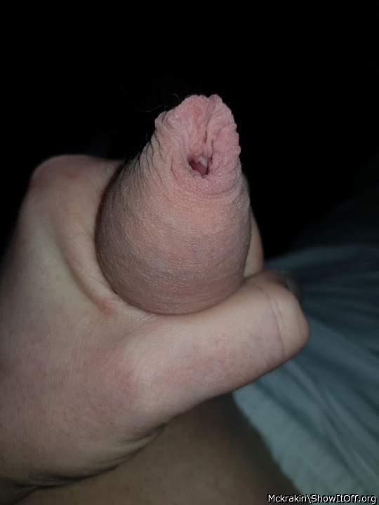 skin anyone