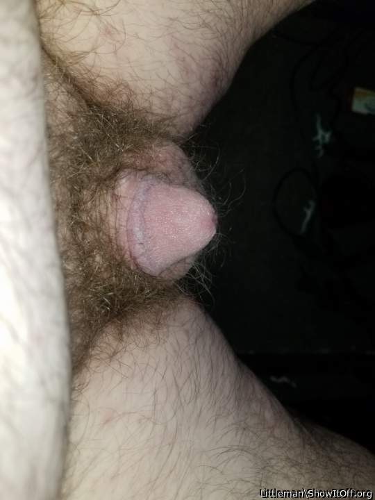 Photo of a short leg from LittleMan