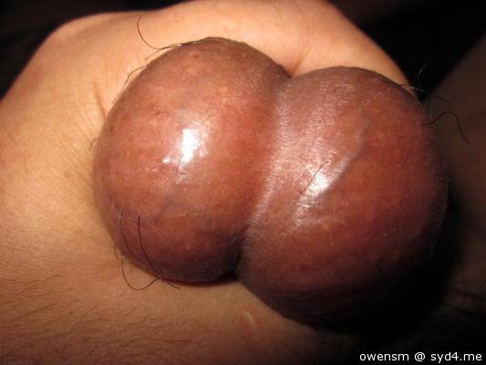 ball5