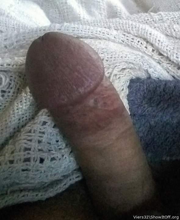 Photo of a private part from Viers32