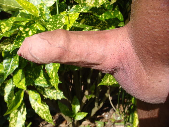 Photo of a short leg from sivad666