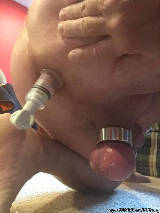 is that a suction cup on your butthole?