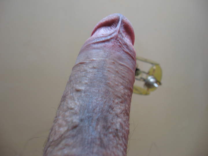 Photo of a penile from porlokino