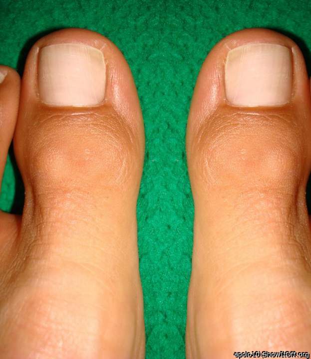 Toes - apolo10