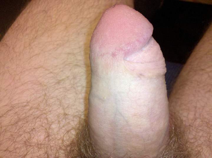 Photo of a short leg from skinb