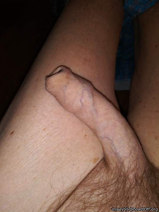 Foreskin