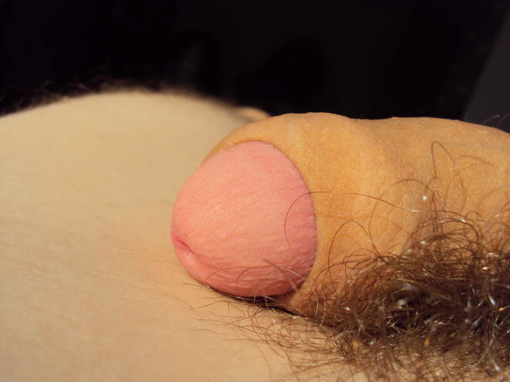 pink glans