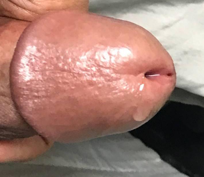 Head drooling