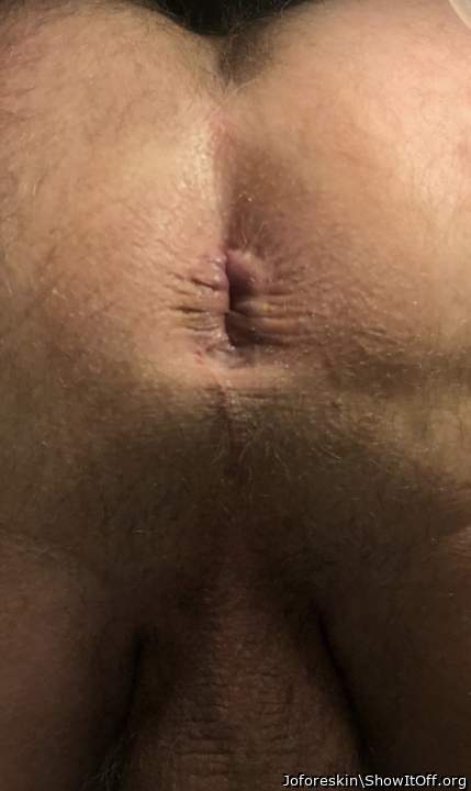 My asshole