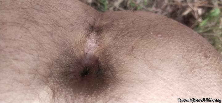 My ass hole