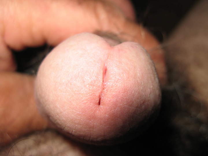 Photo of a cock from turkeyneck