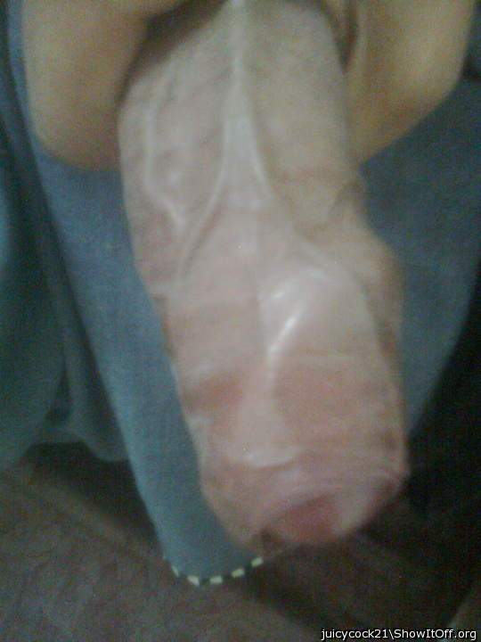vein